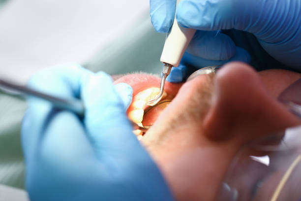Best Walk-In Emergency Dentist in Woodward, IA