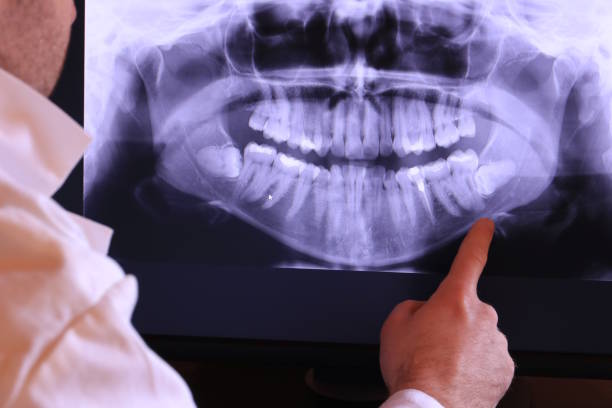 Best Same-Day Emergency Dentist in Woodward, IA