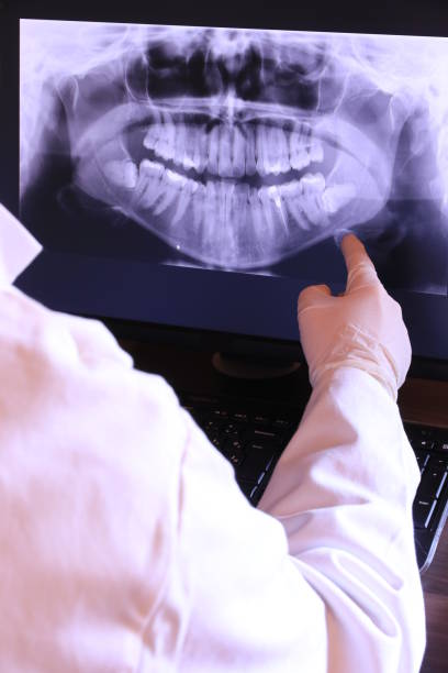 Best Emergency Tooth Extraction in Woodward, IA
