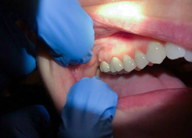 Best Pediatric Emergency Dentist in Woodward, IA